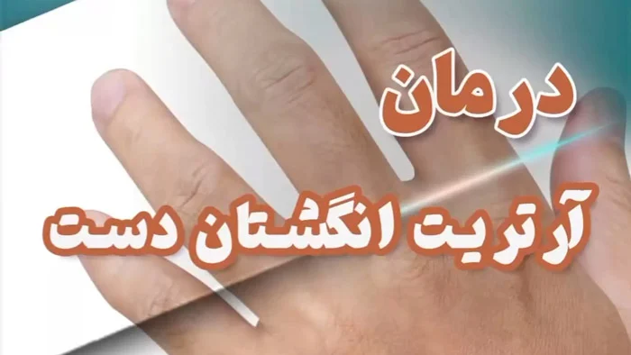 5 روش موثر برای درمان آرتریت انگشتان دست