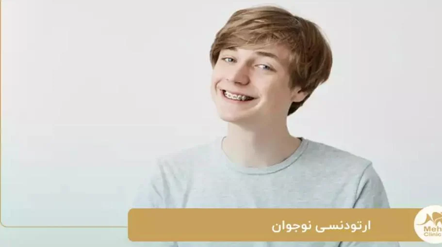 کلینیک دندانپزشکی در شریعتی تهران؛ خدمات حرفه ای ارتودنسی ویژه نوجوانان با جدیدترین روش ها