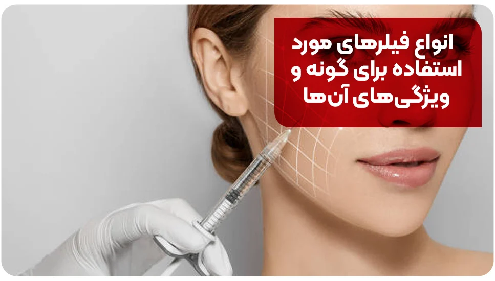 انواع فیلرهای مورد استفاده برای گونه و ویژگی&zwnj;های آن&zwnj;ها